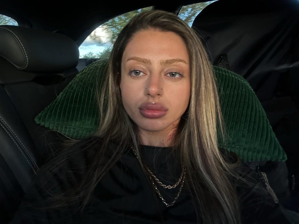 Alizade depicts fire hot images